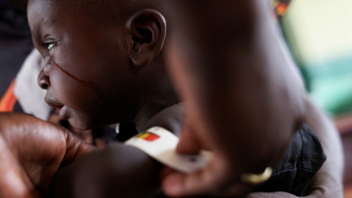The hands of a healthcare worker taking the vitals of a malnourished child in Tudun Gambo, Bauchi state, Nigeria in May 2025