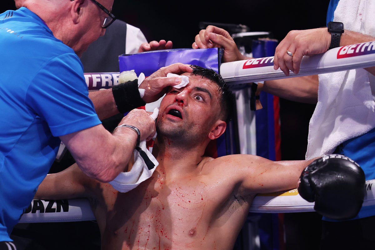 جاك كاتيرال يؤمن فوزًا غريبًا على هارلم Eubank بعد تعرضه لقطع شنيع