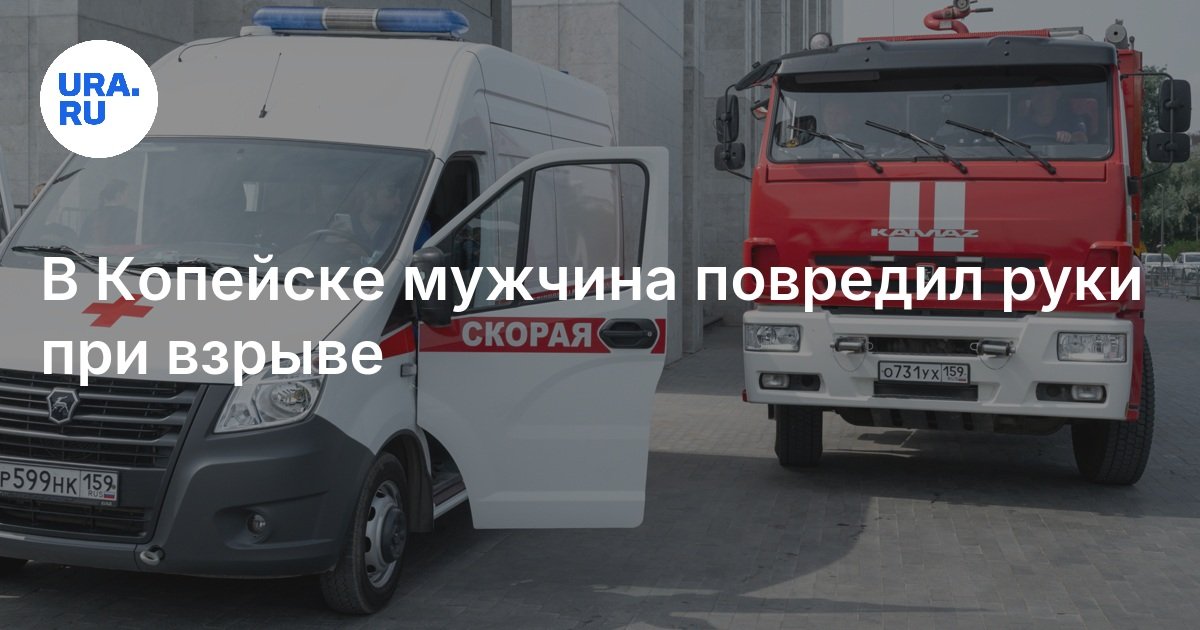 في Kopeysk ، رجل يؤذي يديه أثناء الانفجار