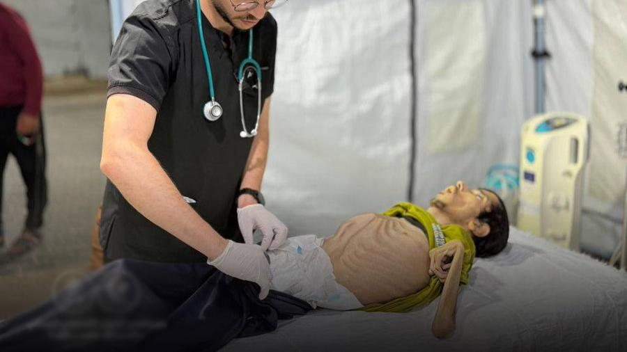 وفاة الرجل الفلسطيني من سوء التغذية بسبب الحصار الإسرائيلي في غزة